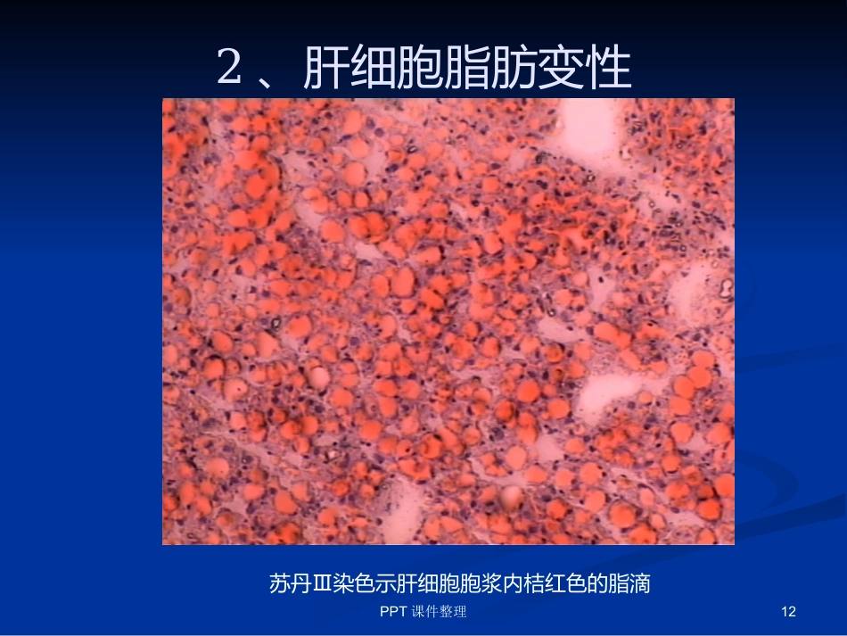 病理学图谱 实验一、细胞组织的适应、损伤与损伤修复_第12页