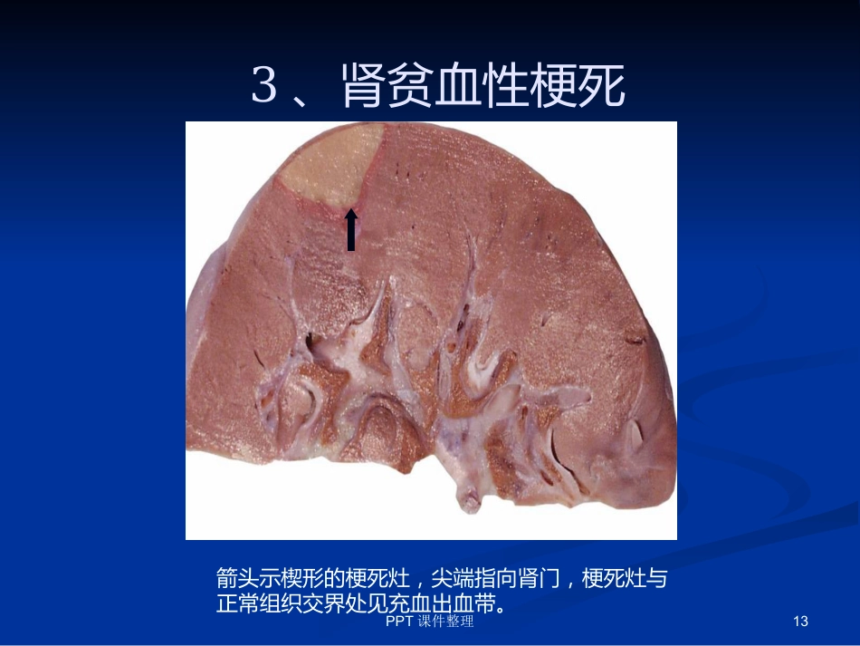 病理学图谱 实验一、细胞组织的适应、损伤与损伤修复_第13页
