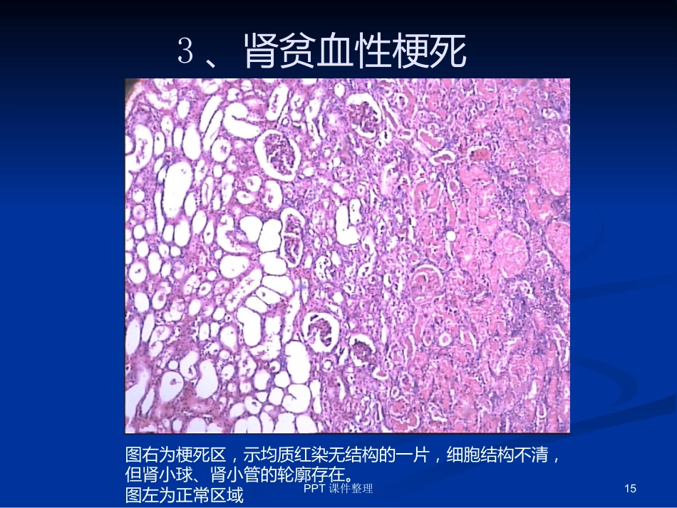 病理学图谱 实验一、细胞组织的适应、损伤与损伤修复_第15页