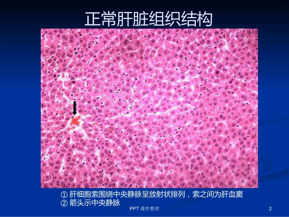 病理学图谱 实验一、细胞组织的适应、损伤与损伤修复_第2页