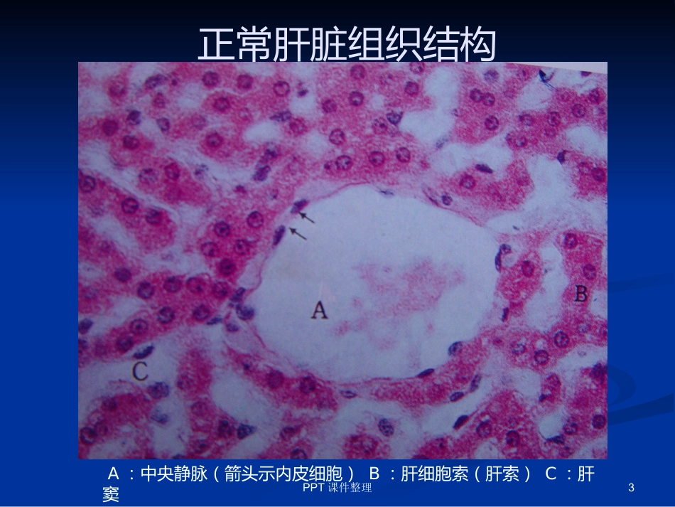 病理学图谱 实验一、细胞组织的适应、损伤与损伤修复_第3页
