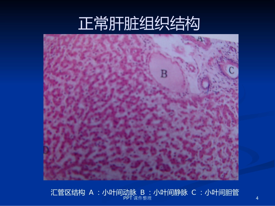 病理学图谱 实验一、细胞组织的适应、损伤与损伤修复_第4页