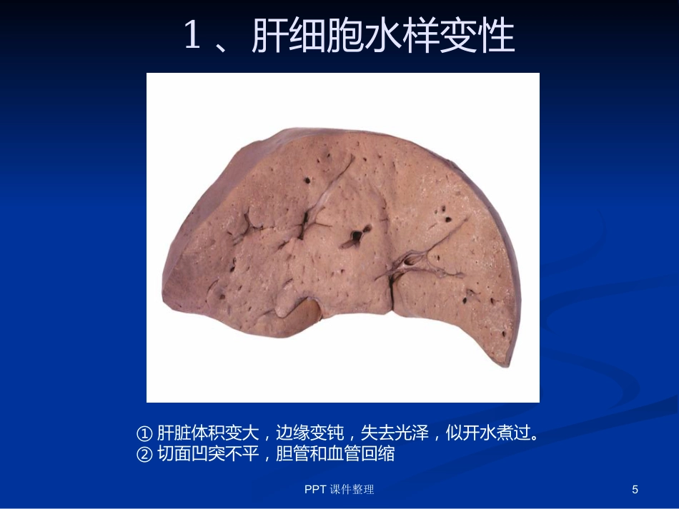 病理学图谱 实验一、细胞组织的适应、损伤与损伤修复_第5页