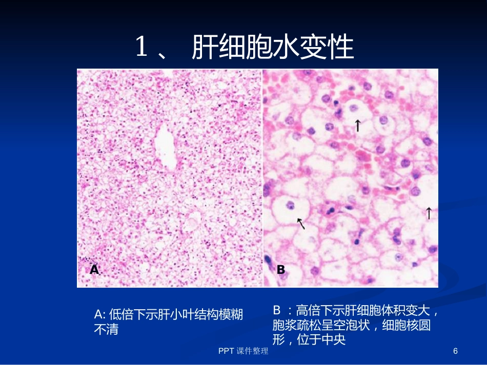 病理学图谱 实验一、细胞组织的适应、损伤与损伤修复_第6页