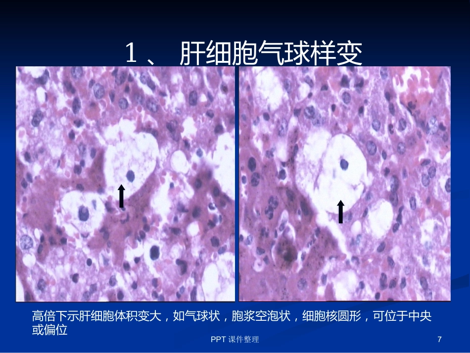 病理学图谱 实验一、细胞组织的适应、损伤与损伤修复_第7页