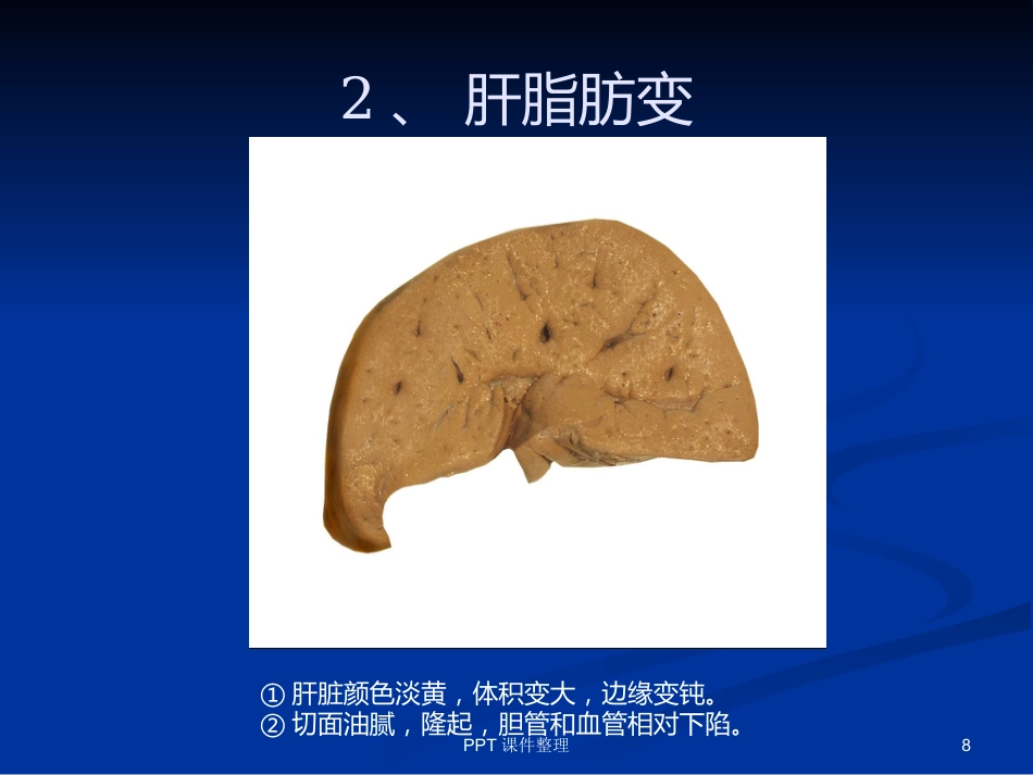 病理学图谱 实验一、细胞组织的适应、损伤与损伤修复_第8页