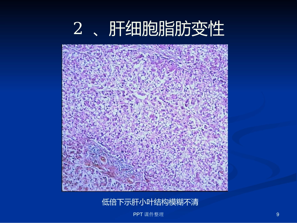 病理学图谱 实验一、细胞组织的适应、损伤与损伤修复_第9页