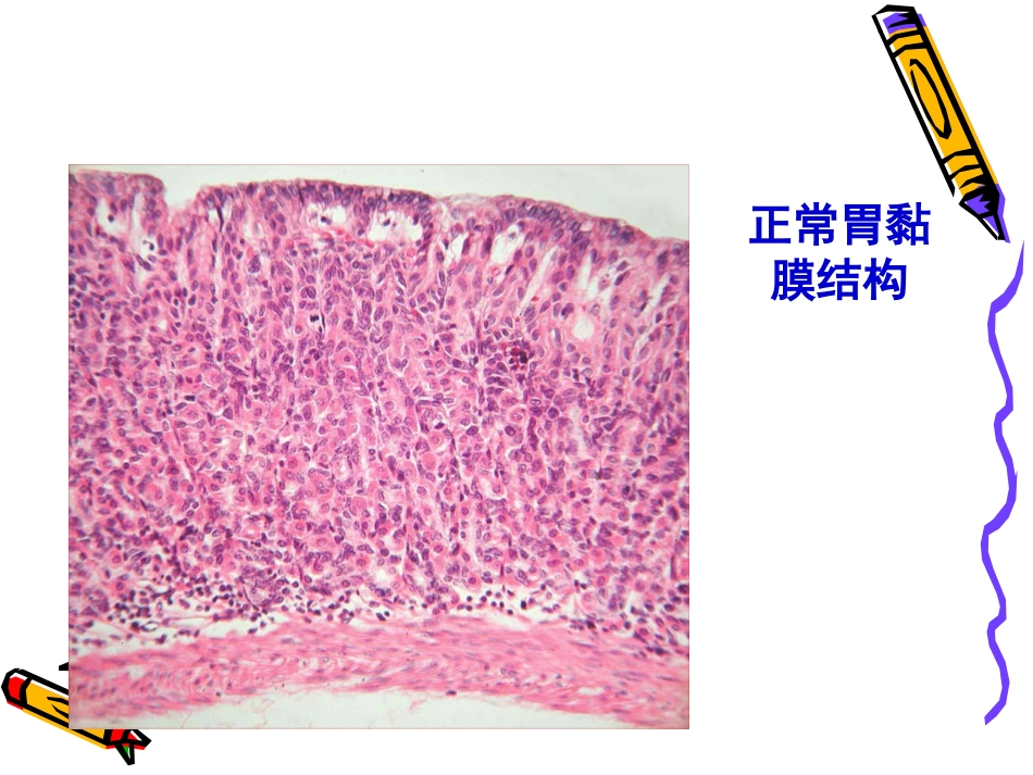 病理学--消化系统疾病_第12页