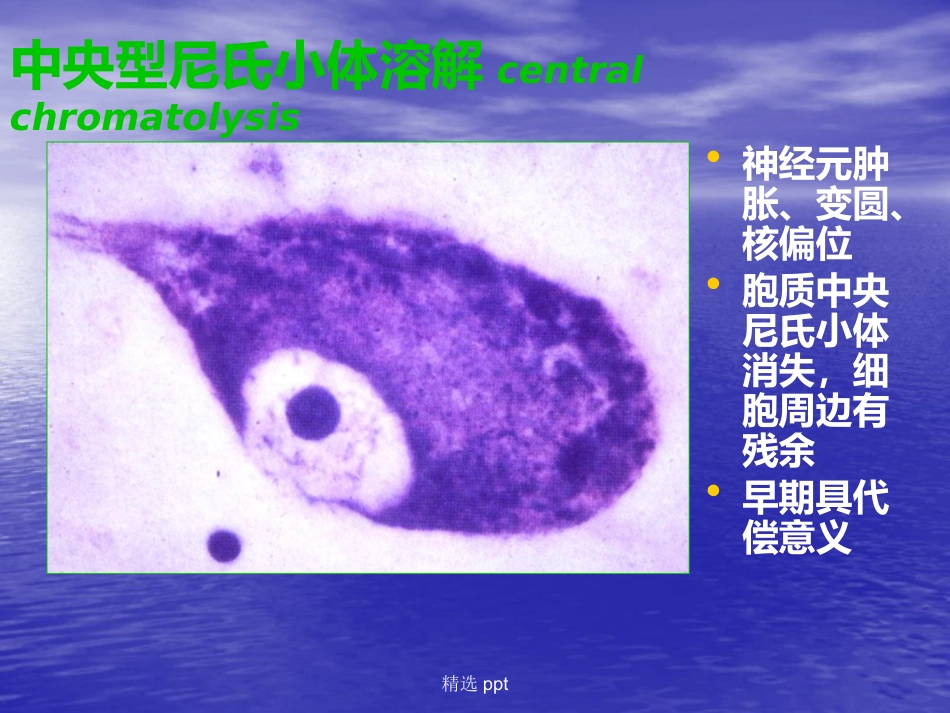 病理学神经系统疾病_第12页