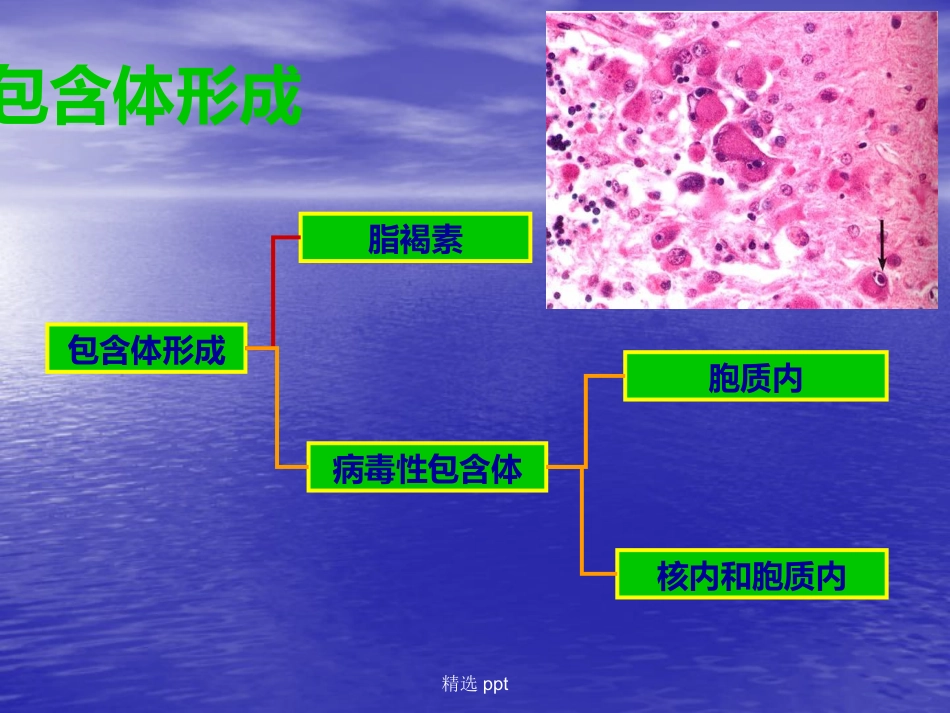 病理学神经系统疾病_第14页