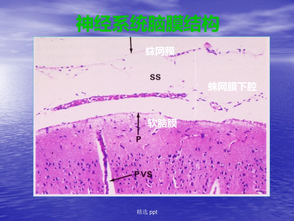 病理学神经系统疾病_第5页