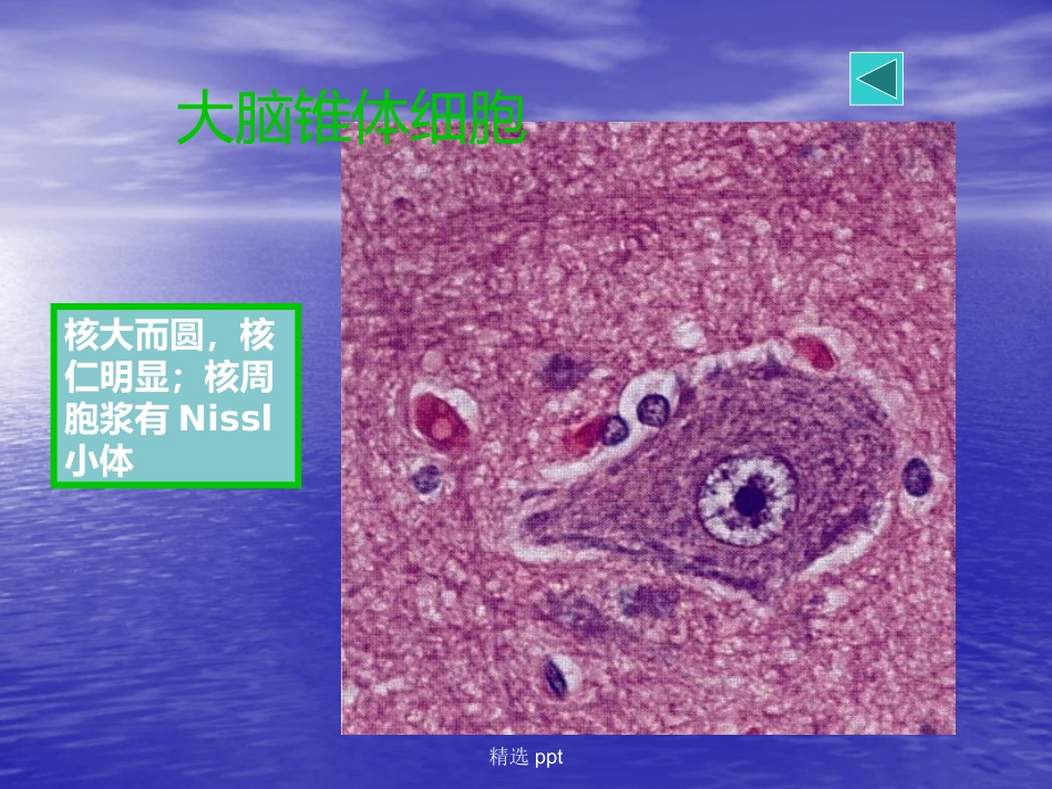 病理学神经系统疾病_第8页