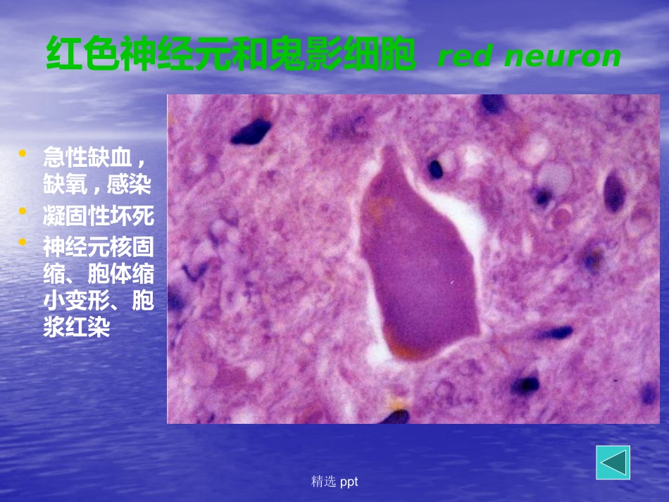 病理学神经系统疾病_第9页