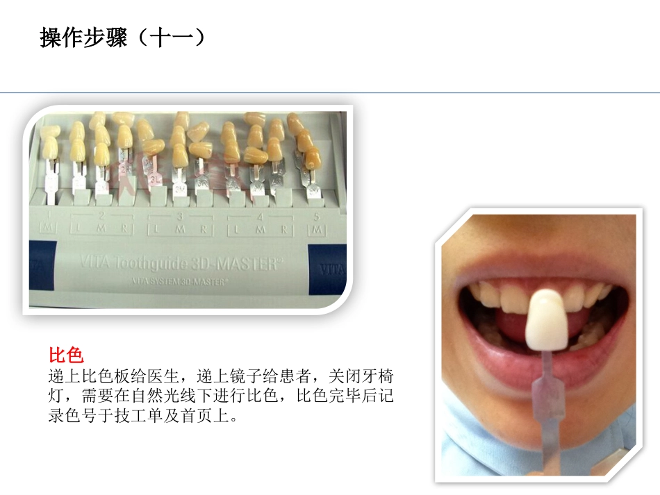 PZ-imp-TEK入四手操作配合_第14页