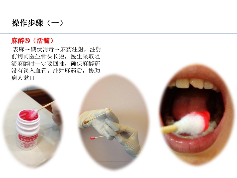 PZ-imp-TEK入四手操作配合_第4页