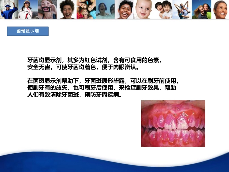 口腔培训020.牙周病_第2页