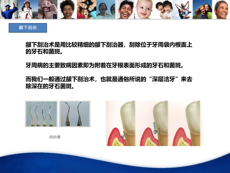 口腔培训020.牙周病_第7页