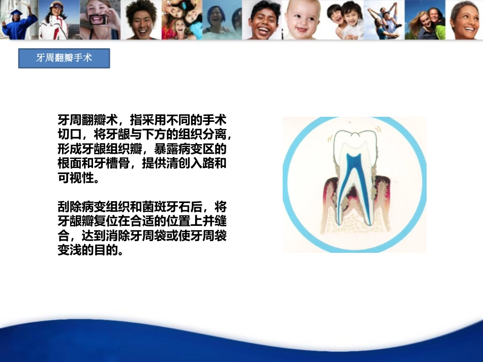 口腔培训020.牙周病_第8页
