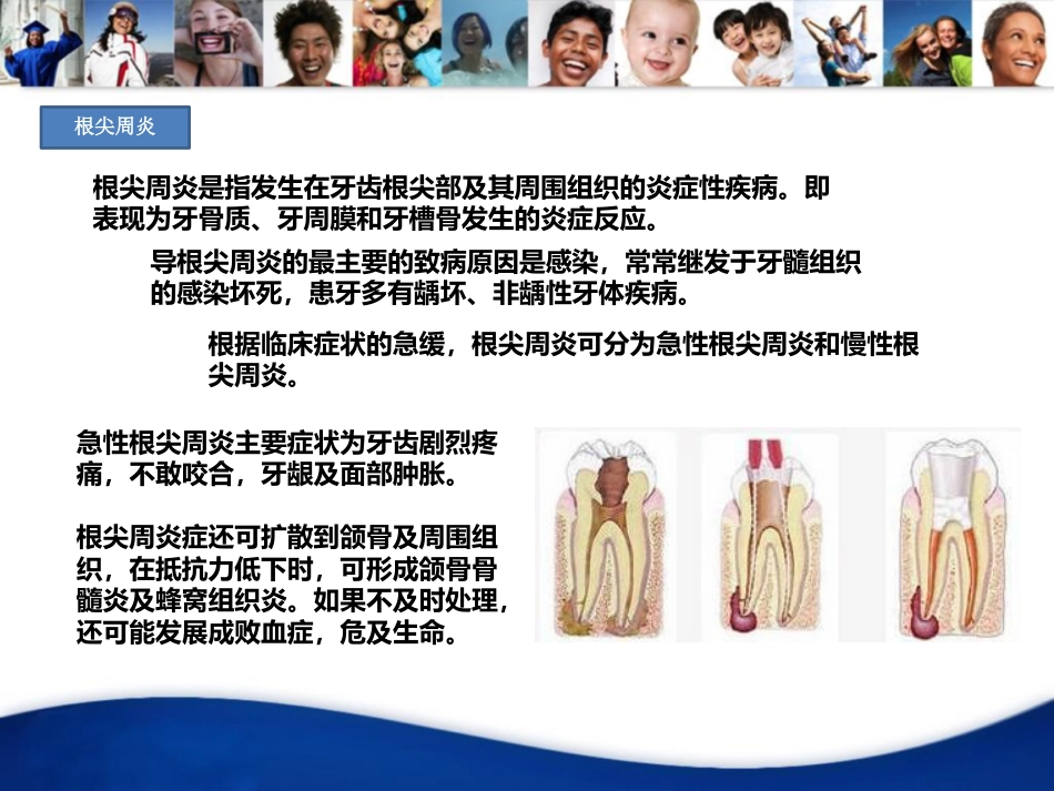 口腔培训022.-龋齿_第4页