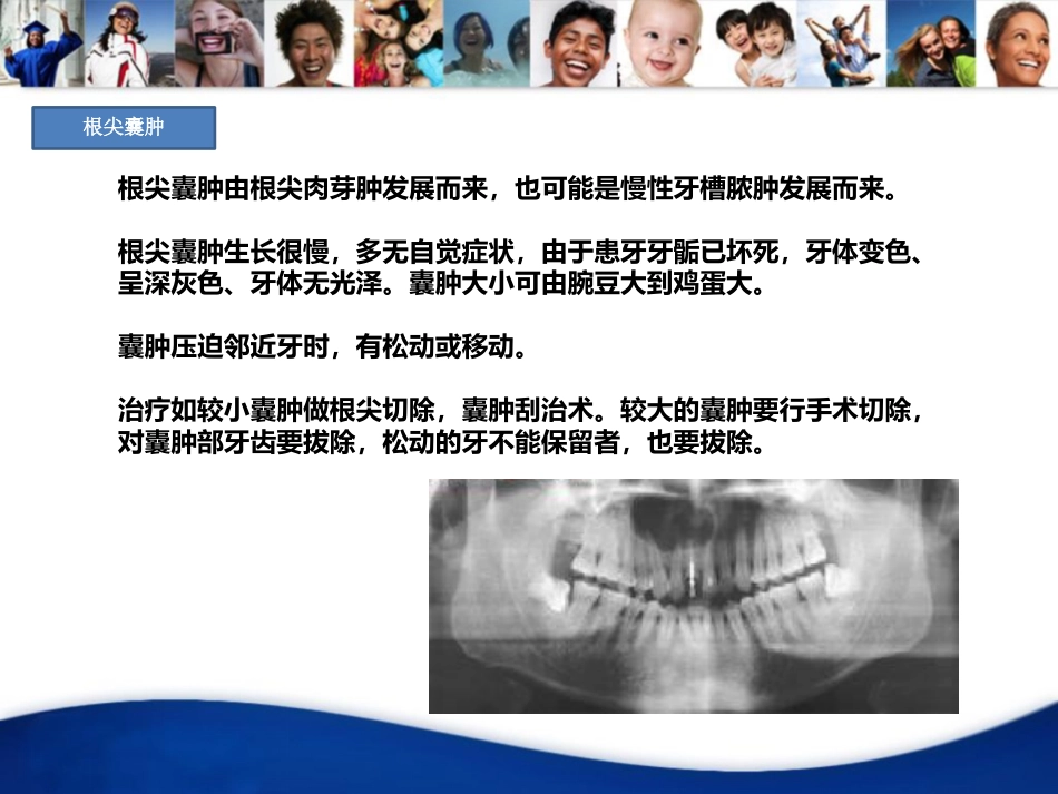 口腔培训022.-龋齿_第5页