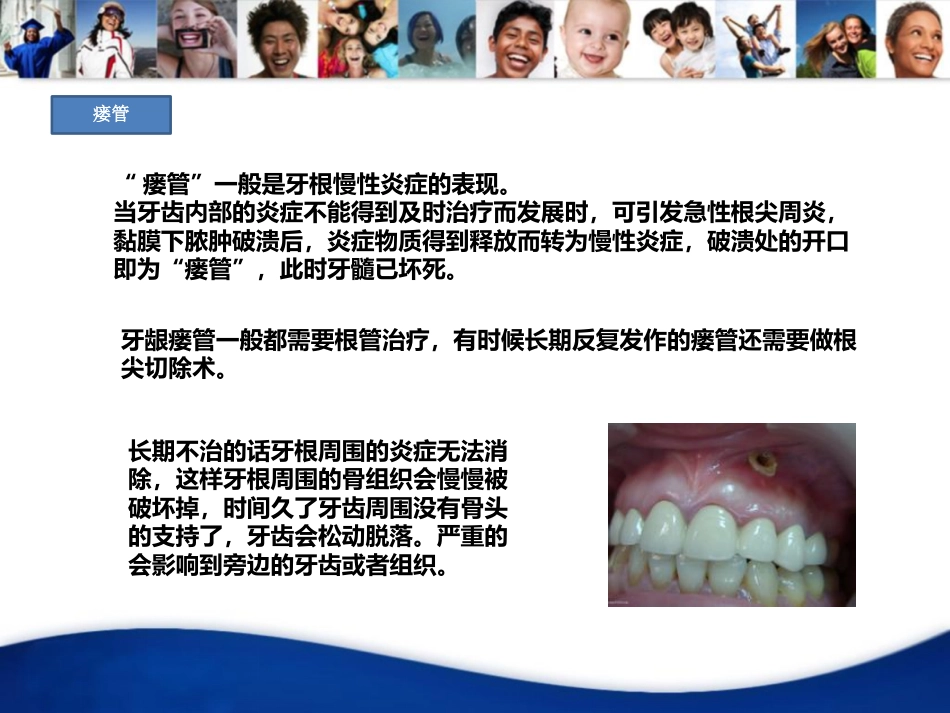 口腔培训022.-龋齿_第6页