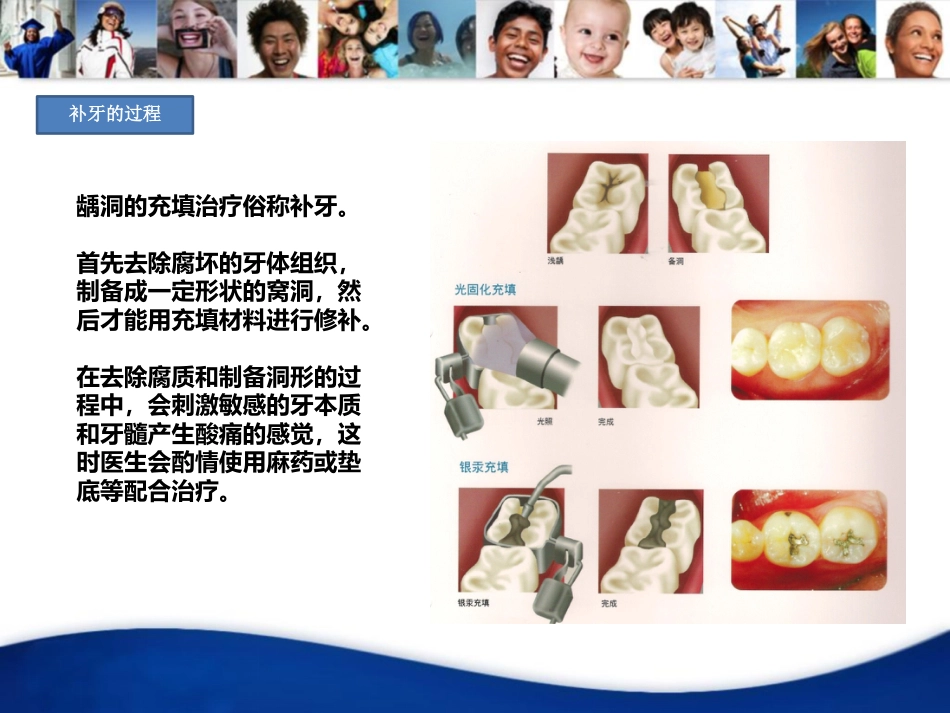 口腔培训022.-龋齿_第7页