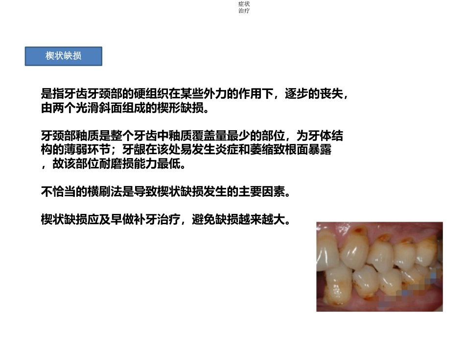 口腔培训022.-龋齿_第9页