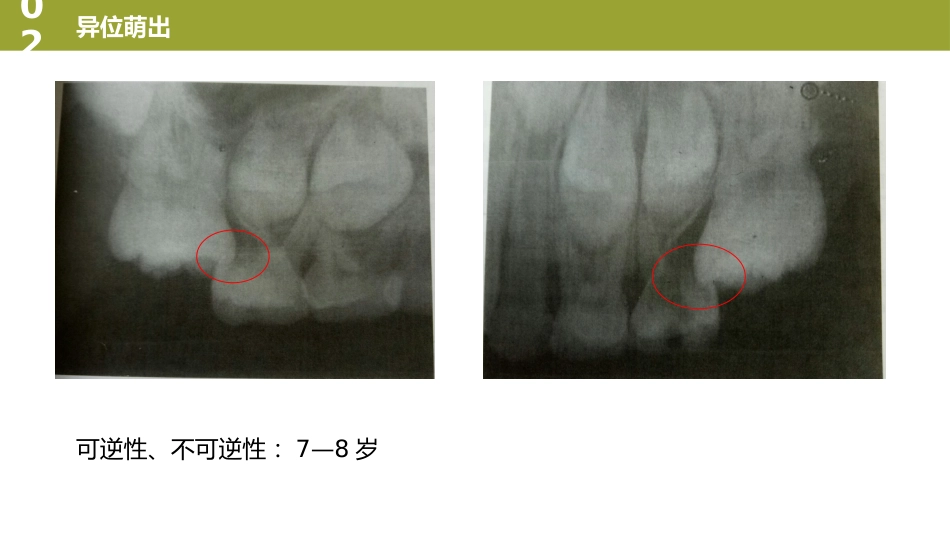 口腔培训023.萌出情况_第4页