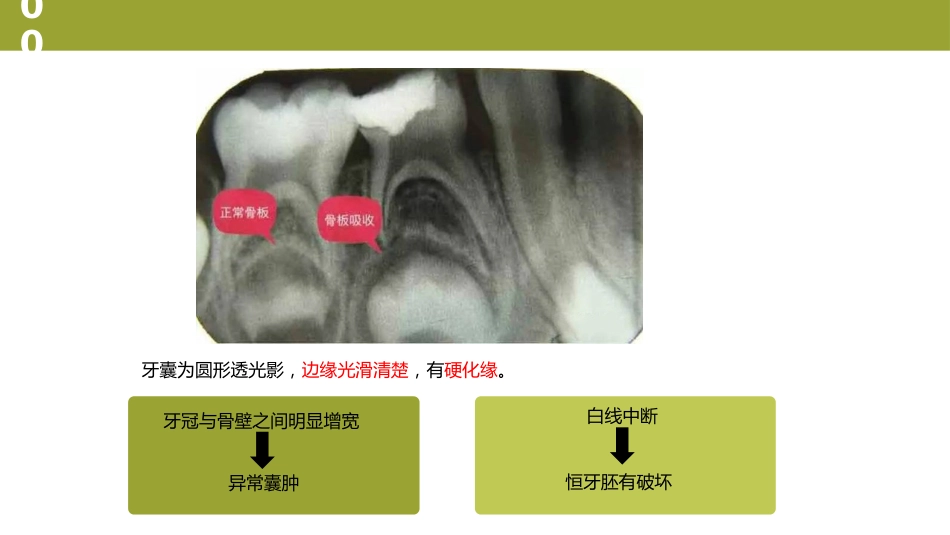口腔培训023.萌出情况_第7页