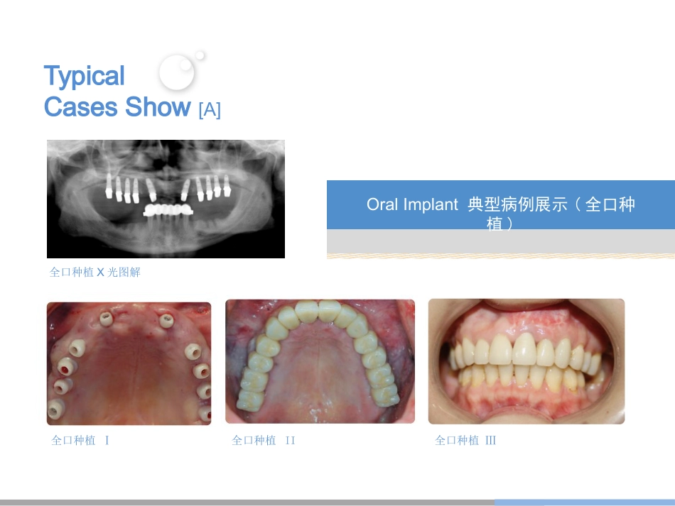 口腔培训024.种植_第14页