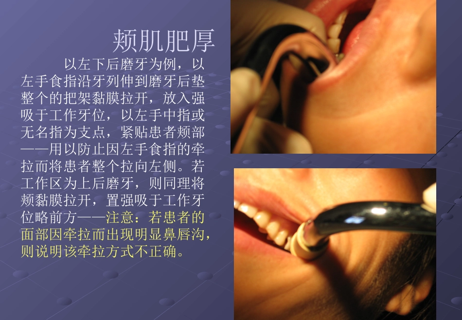 口腔培训026.吸唾手法_第10页