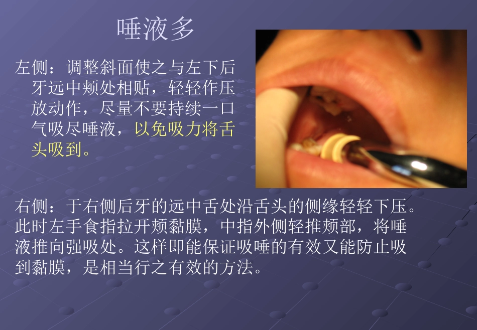 口腔培训026.吸唾手法_第11页