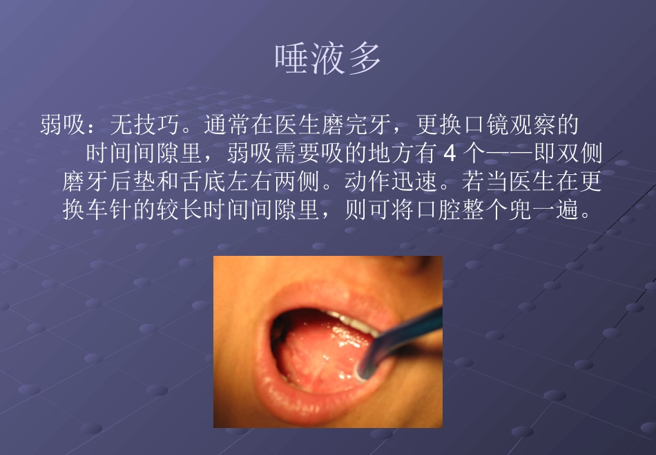 口腔培训026.吸唾手法_第12页