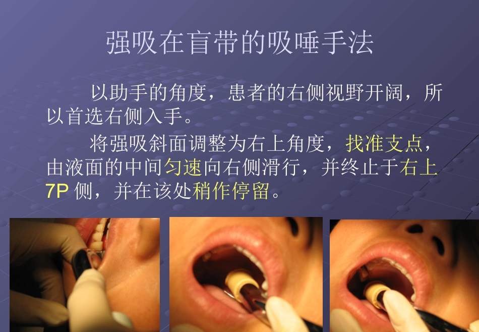 口腔培训026.吸唾手法_第14页