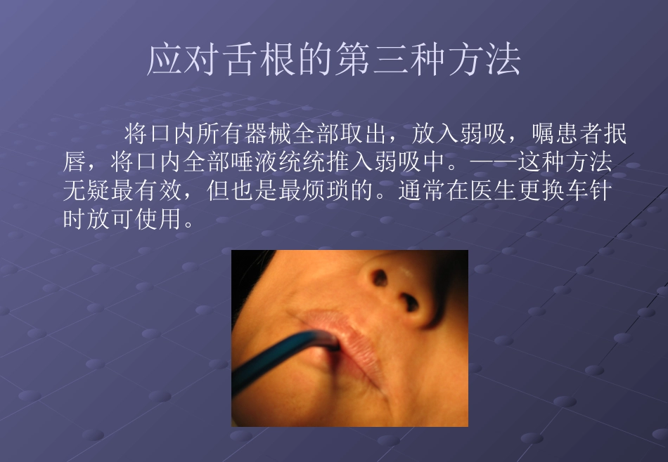 口腔培训026.吸唾手法_第15页