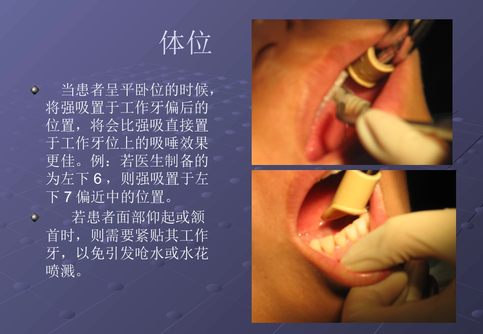 口腔培训026.吸唾手法_第3页