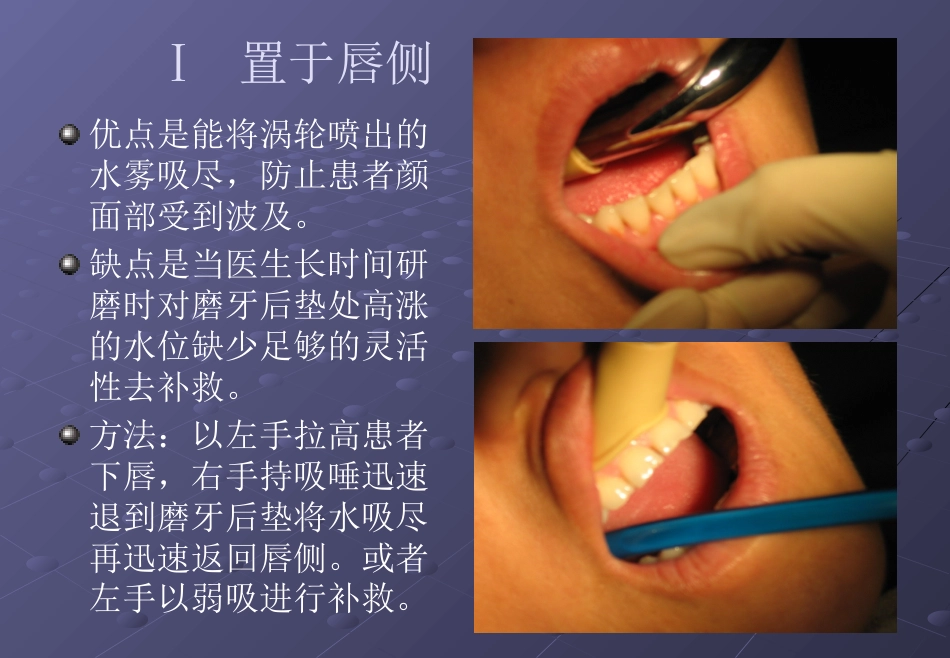 口腔培训026.吸唾手法_第6页