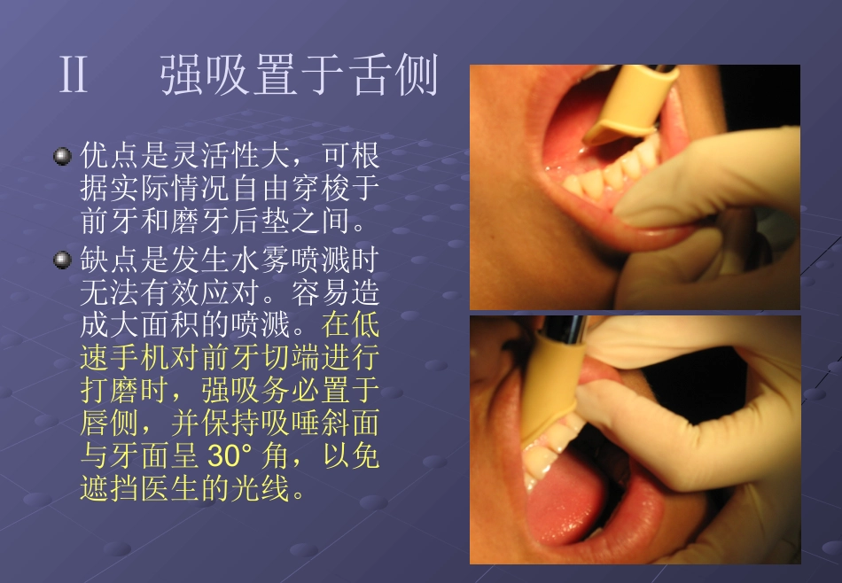 口腔培训026.吸唾手法_第7页
