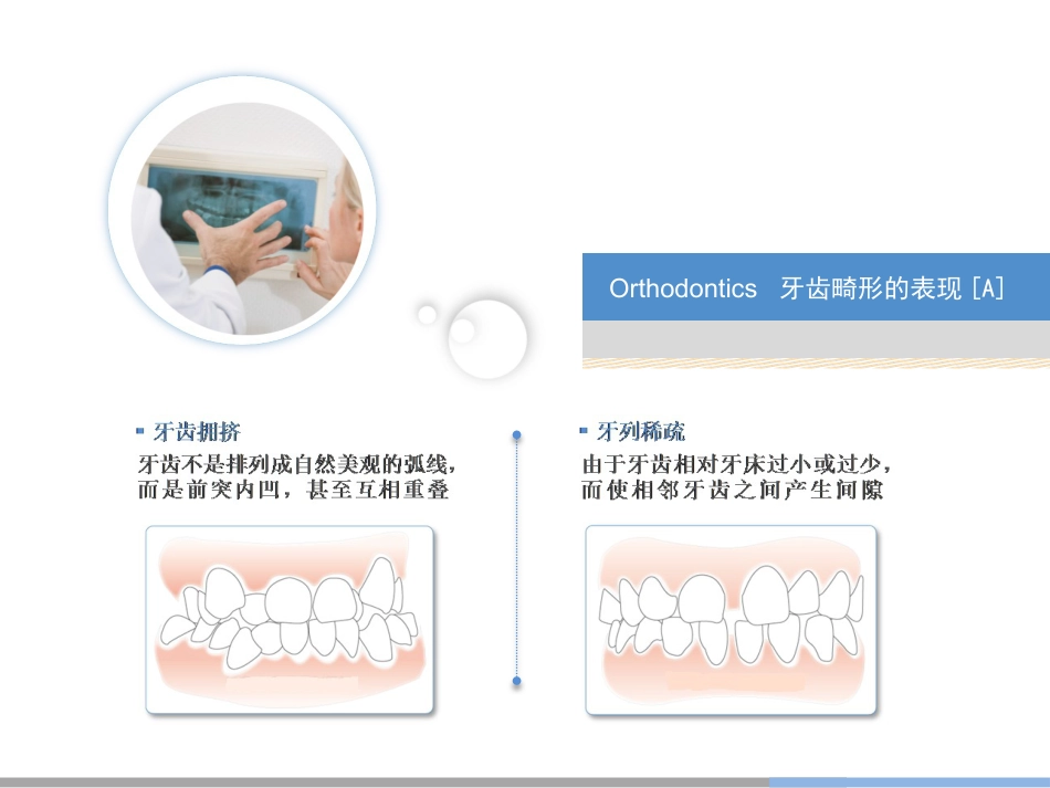 口腔培训027.正畸_第4页