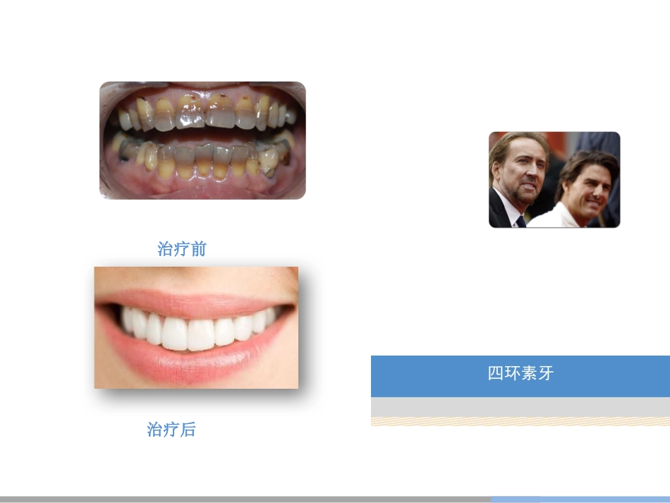 口腔培训028.美容齿科_第3页