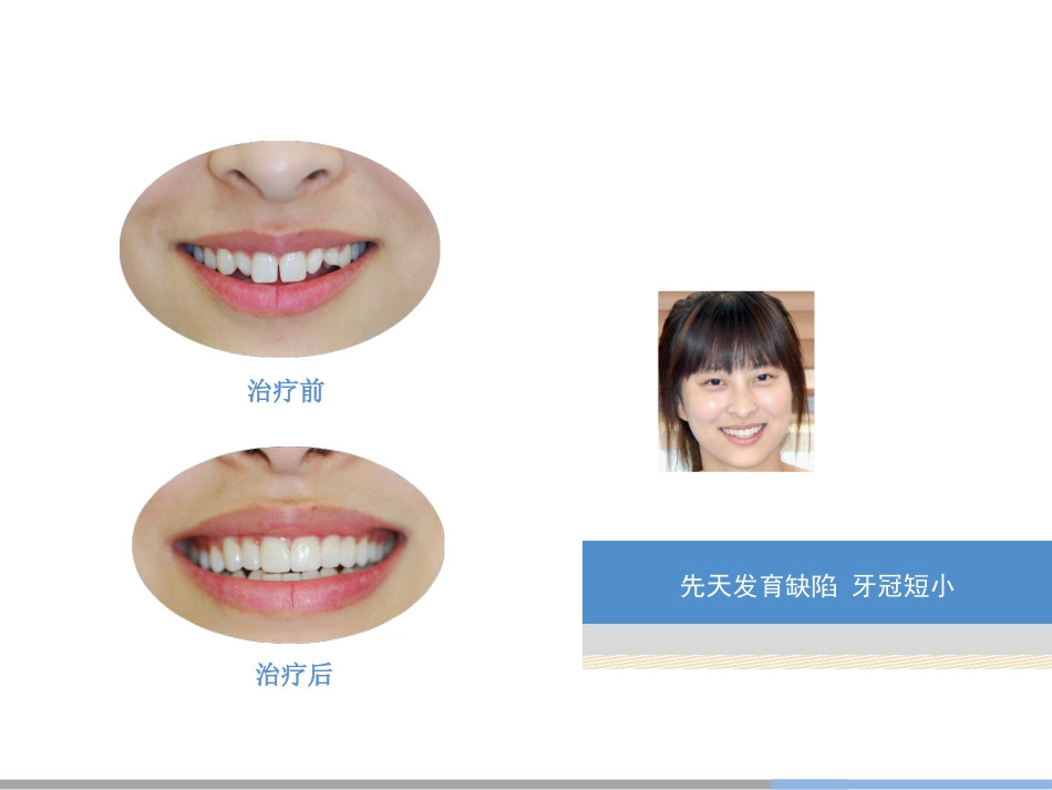 口腔培训028.美容齿科_第4页