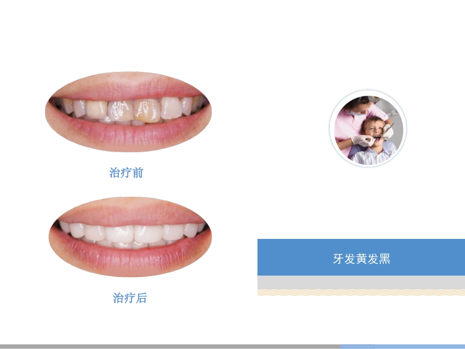 口腔培训028.美容齿科_第6页