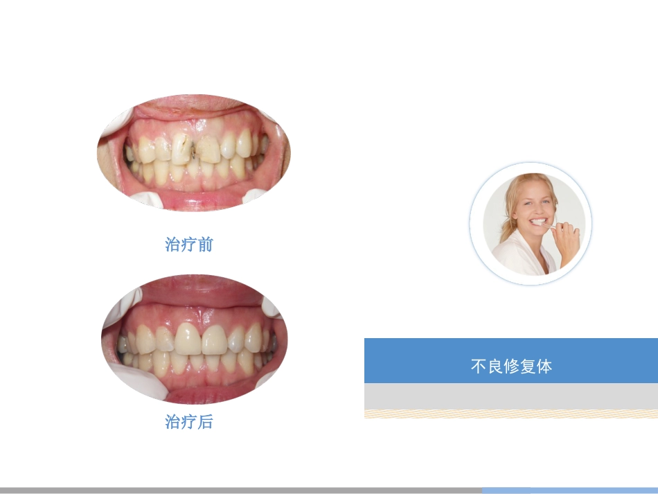 口腔培训028.美容齿科_第8页