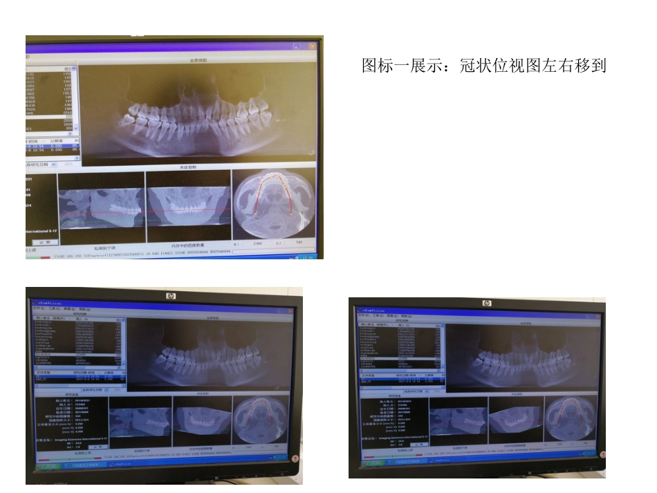 口腔培训031.CBCT观察(1)_第11页