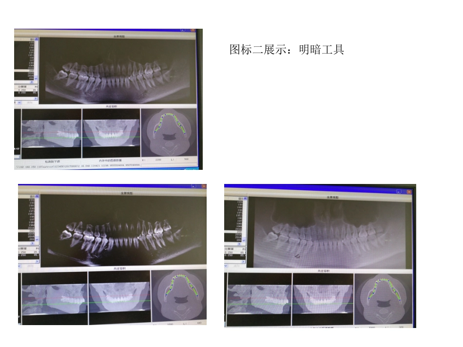 口腔培训031.CBCT观察(1)_第12页