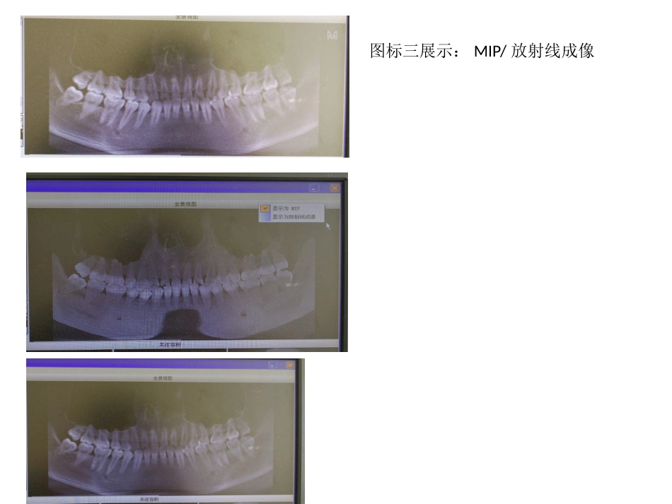 口腔培训031.CBCT观察(1)_第13页