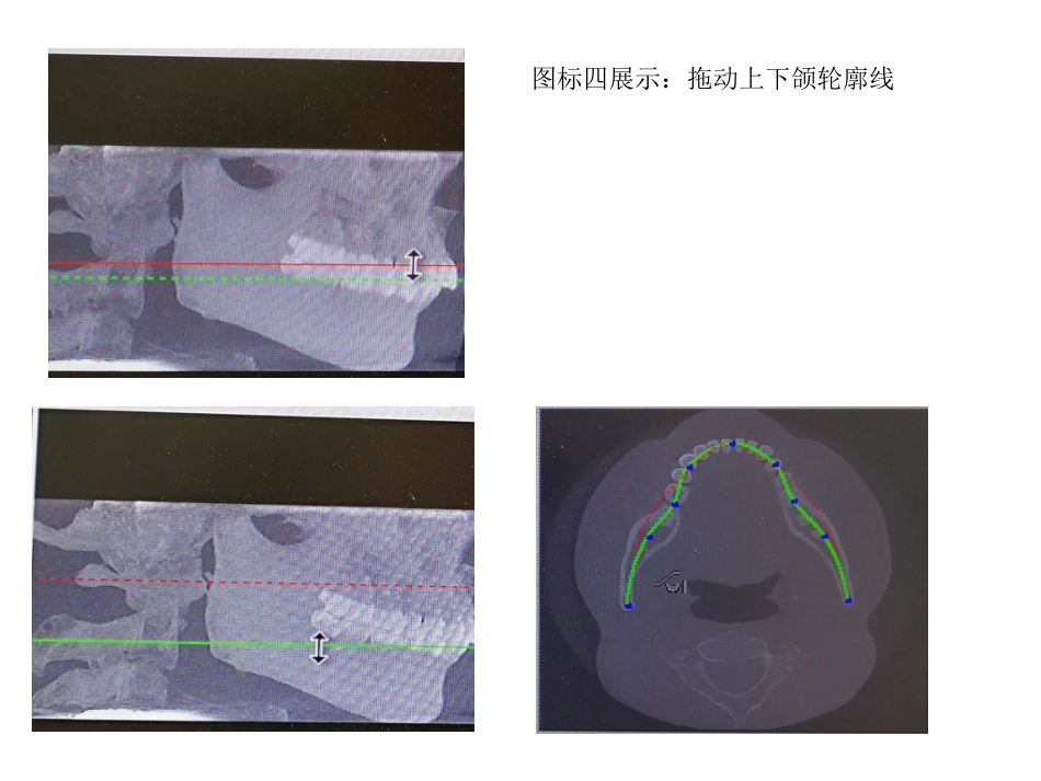 口腔培训031.CBCT观察(1)_第14页
