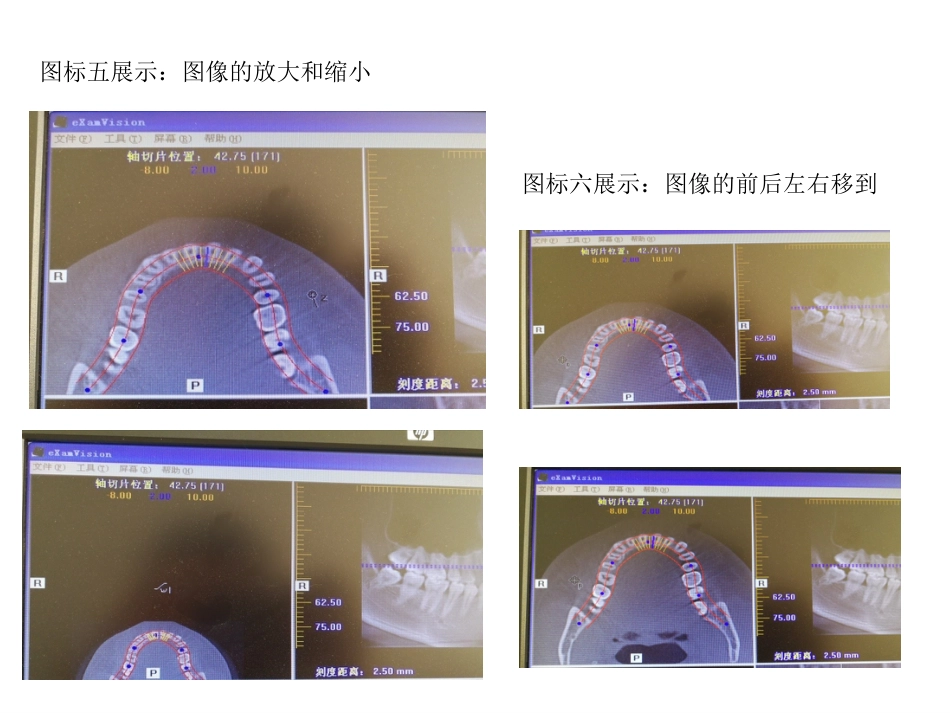 口腔培训031.CBCT观察(1)_第15页