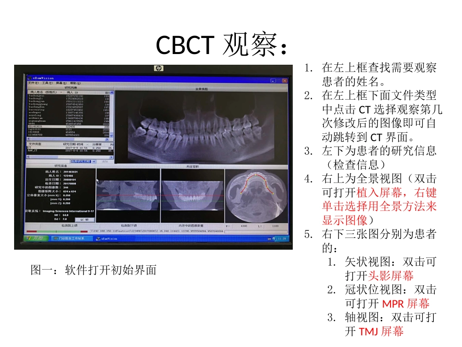 口腔培训031.CBCT观察(1)_第7页