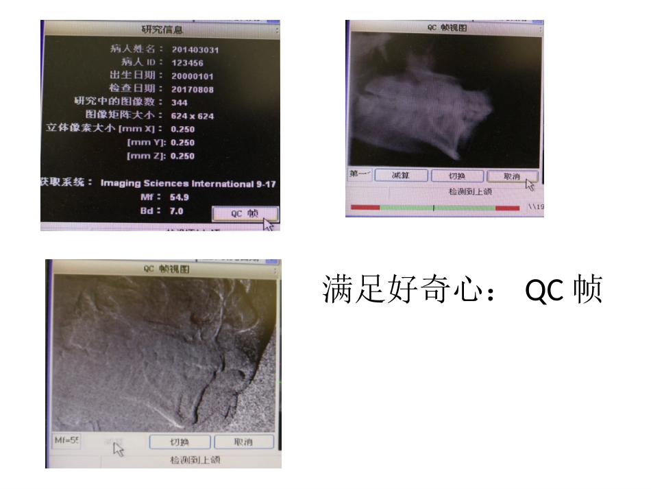 口腔培训031.CBCT观察(1)_第8页